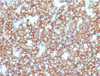 Recombinant CD20 Antibody / Rabbit Monoclonal