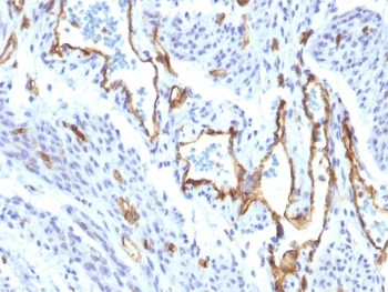 Recombinant CD31 Antibody / Rabbit Monoclonal