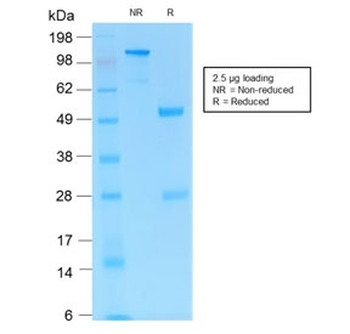 Recombinant CD31 Antibody / Rabbit Monoclonal