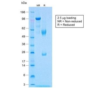 Recombinant Calponin Antibody / Rabbit Monoclonal