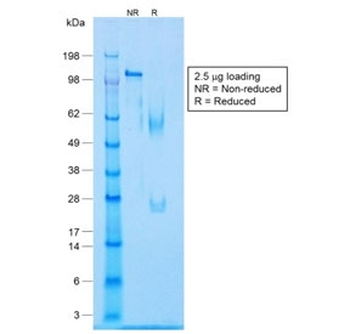 Recombinant Caldesmon Antibody / CALD1 / CAD (HMW)