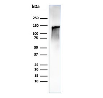 Recombinant Caldesmon Antibody / CALD1 / CAD (HMW)