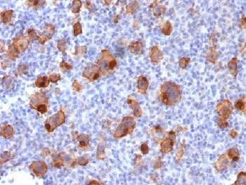 Recombinant CD30 Antibody / Rabbit Monoclonal