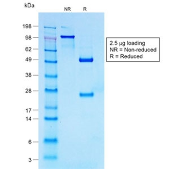 Recombinant CD30 Antibody / Rabbit Monoclonal