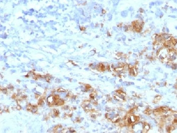 Recombinant CA19-9 Antibody / Rabbit Monoclonal