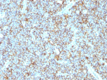 Recombinant CD99 Antibody / Rabbit Monoclonal