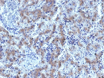 Recombinant Glypican-3 Antibody / Rabbit Monoclonal