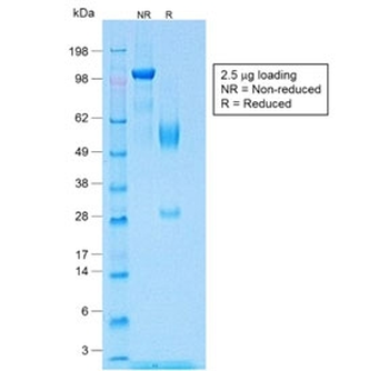 Recombinant WT1 Antibody / Rabbit Monoclonal