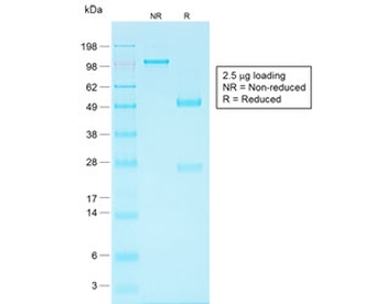 Recombinant Ep-CAM Antibody / Rabbit Monoclonal