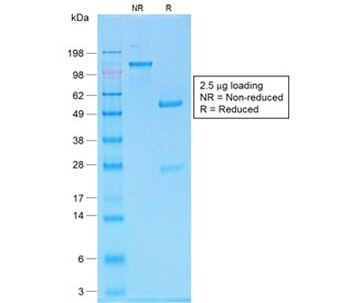 Recombinant Melan-A Antibody / Rabbit Monoclonal