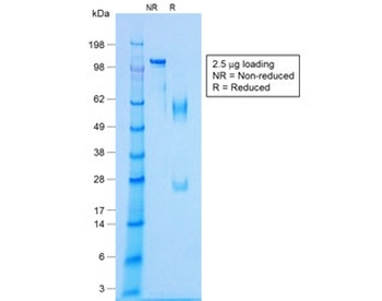 Recombinant NKX2.2 Antibody / Rabbit Monoclonal