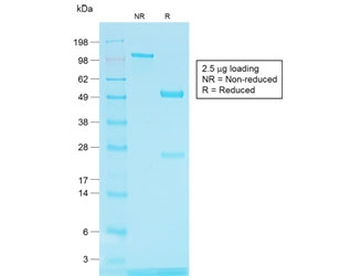 Recombinant TYRP1 Antibody / Tyrosinase Related Protein 1 / TRP1