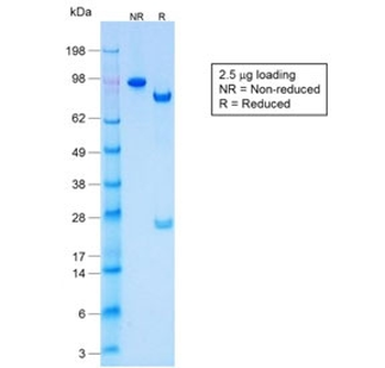 Recombinant Acidic Cytokeratin Antibody / Rabbit Monoclonal