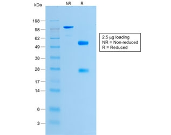 Recombinant Histone H1 Antibody / Rabbit Monoclonal