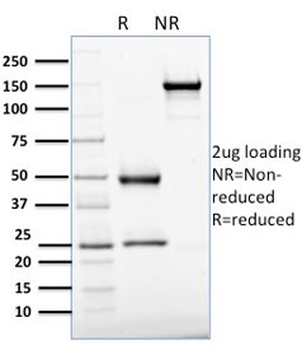 APE1 Antibody / APEX1