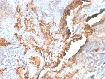 Recombinant Tenascin C Antibody