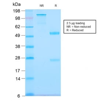 Recombinant Tenascin C Antibody