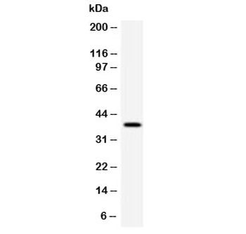 RPSA Antibody / 40S Ribosomal protein SA / Laminin Receptor 1