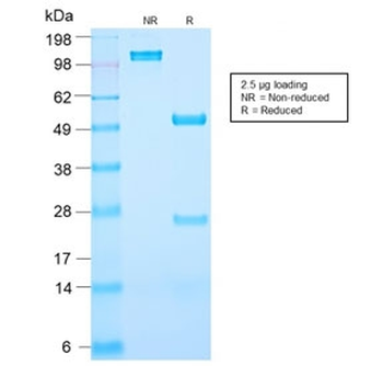 Recombinant PSA Antibody / Prostate Specific Antigen
