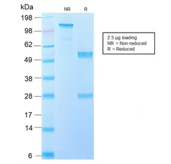 Recombinant IL-10 Antibody