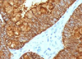 Recombinant AURKB Antibody / Aurora B