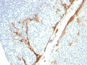 Recombinant Cytokeratin 16 Antibody