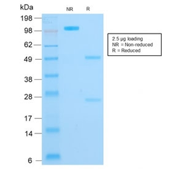 Recombinant Cytokeratin 16 Antibody