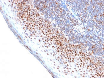 Recombinant MCM7 Antibody