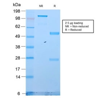 Recombinant Cytokeratin 18 Antibody