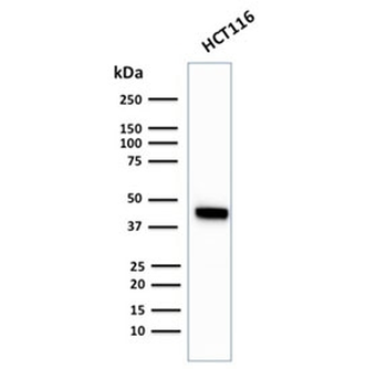 Recombinant Cytokeratin 18 Antibody