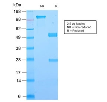 Recombinant Galectin 1 Antibody