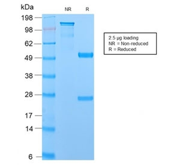 Recombinant MUC1 Antibody / Mucin-1