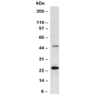 Recombinant Mammaglobin A Antibody / SCGB2A2
