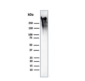 Recombinant Mucin-1 Antibody / Rabbit Monoclonal
