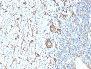 Recombinant Neurofilament Antibody / Heavy