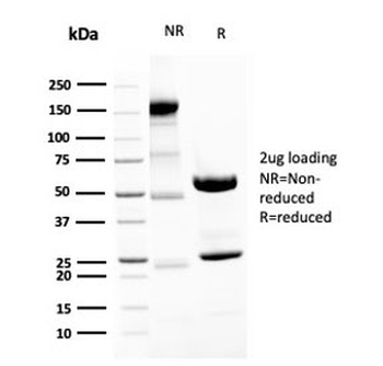 Recombinant Neurofilament Antibody / Heavy