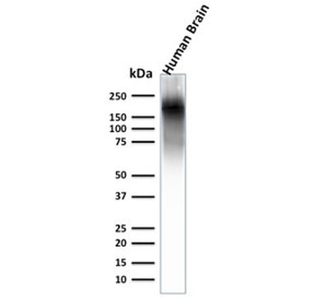 Recombinant Neurofilament Antibody / Heavy