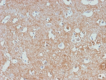 Recombinant Neurofilament Antibody
