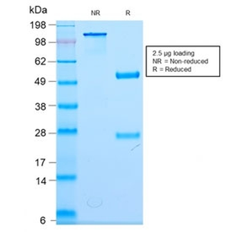 Recombinant Neurofilament Antibody