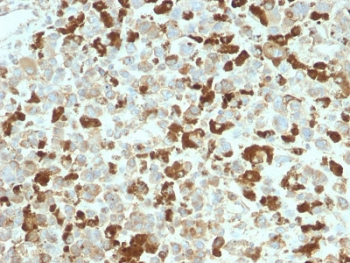 Recombinant NGFR Antibody / p75NTR