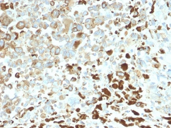 Recombinant NGFR Antibody / p75NTR