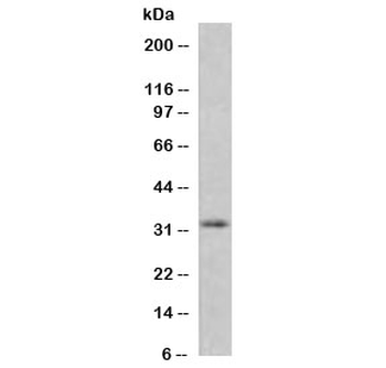 Recombinant MTAP Antibody / S-methyl-5'-thioadenosine phosphorylase