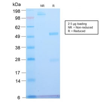 Recombinant ATRX Antibody / RAD54