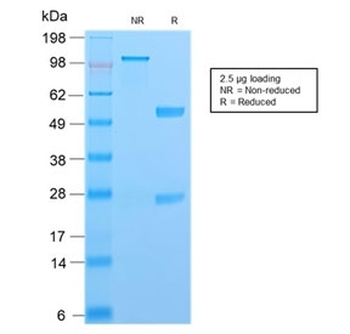 Recombinant S100A4 Antibody / FSP1