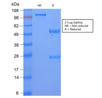 Recombinant SAA Antibody / SAA1 + SAA2