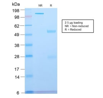 Recombinant Spectrin beta III Antibody / SPTBN2