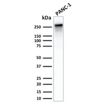 Recombinant Spectrin beta III Antibody / SPTBN2
