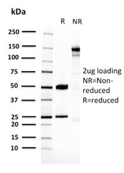 14-3-3 epsilon Antibody / YWHAE