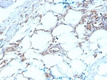 Calretinin Antibody / CALB2 / Calbindin 2