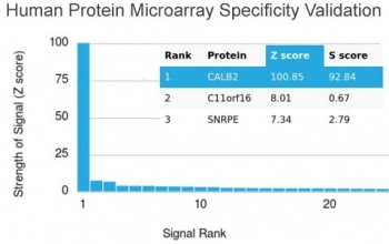 Calretinin Antibody / CALB2 / Calbindin 2